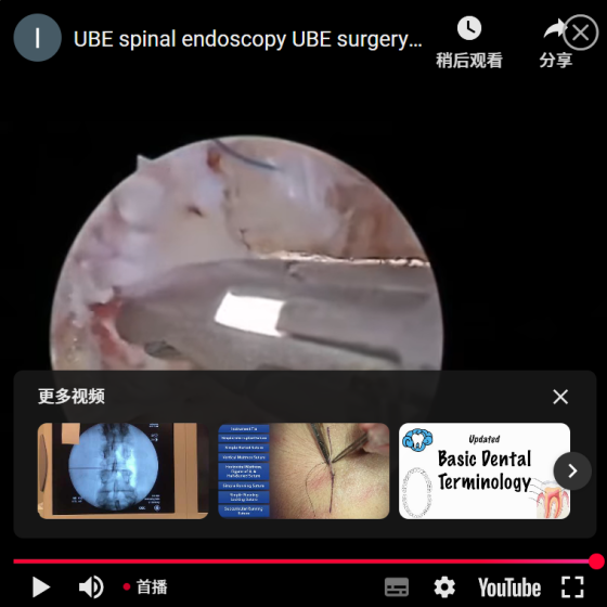 UBE colonne vertébrale endoscopie UBE chirurgie suture fibre-anneau vidéo